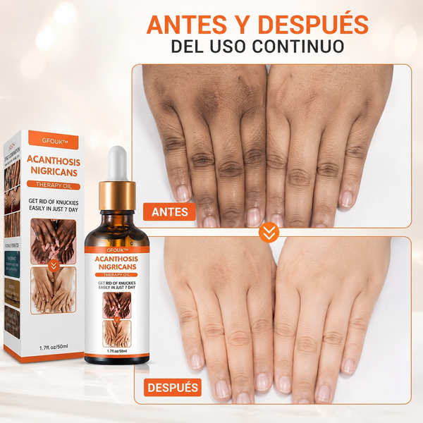 SERUM GLOW™ Corrector de Manchas Piel Oscura